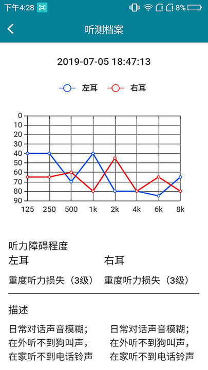 亿耳助听